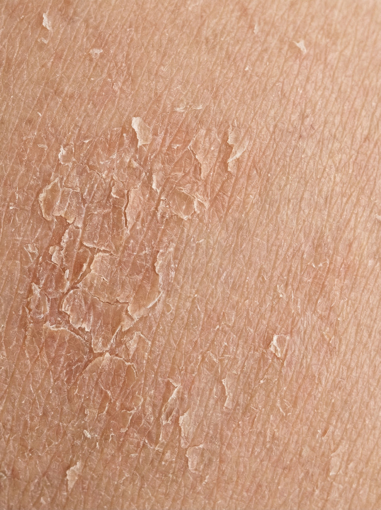 SKIN|CYCLES | Science-Based Skincare & Anti-Aging